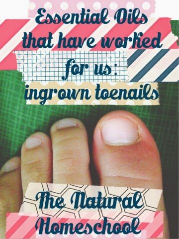 In this post, I will share with you the best essential oils that have worked for us for ingrown toenails. So read on to find out what are the best essential oils for ingrown toenail. 