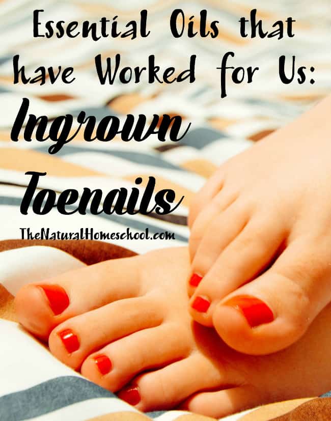 In this post, I will share with you the best essential oils that have worked for us for ingrown toenails. So read on to find out what are the best essential oils for ingrown toenail. 